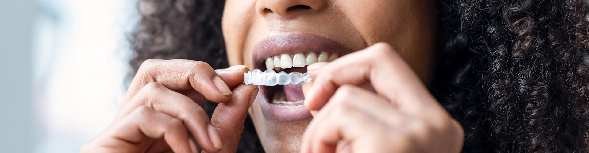 woman placing clear aligner in her mouth